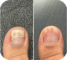 Before and After Result 1