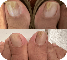 Before and After Result 3